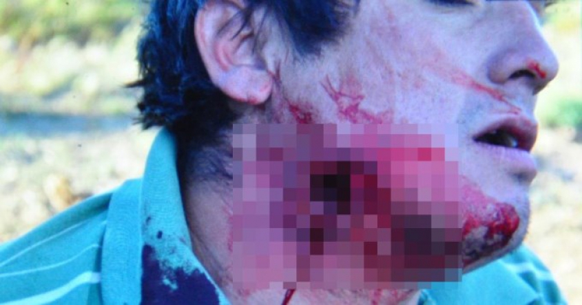 Desde el Litoral, repudian la represión al pueblo mapuche