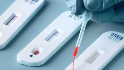 Autotest: investigador pone en duda su efectividad para el abordaje de la pandemia